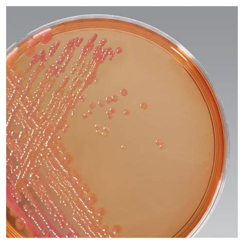 Salmonella Shigella Agar