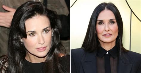 Demi Moore Plastic Surgery: An In-depth Analysis ...