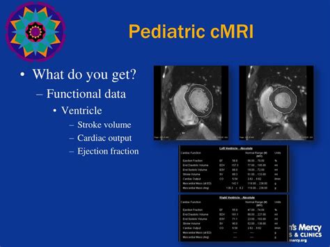 PPT - State of the Art: Pediatric Cardiac MRI PowerPoint Presentation ...