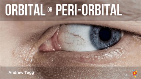 Peri-orbital vs orbital cellulitis - Don't Forget the Bubbles