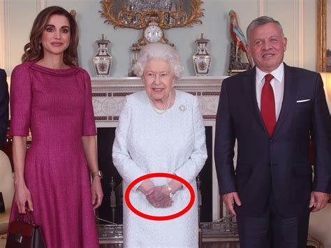 Queen Elizabeth, Prince Charles: Truth about royals’ purple hands | news.com.au — Australia’s ...