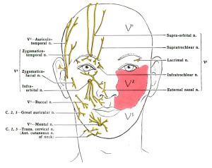 Nerve Block: Infraorbital - WikEM