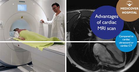 The potential advantages of cardiac MRI scan compared to cardiac ...