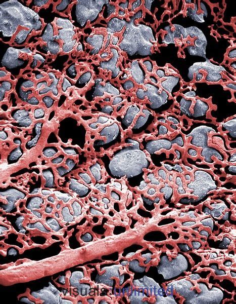 Capillaries and alveoli in the lung | Microscopic photography, Electron microscope images ...