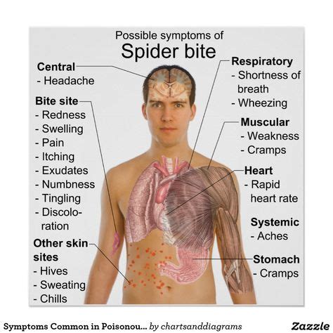 Signs Of A Poisonous Spider Bite Symptoms common in poisonous | Spider bite symptoms, Spider ...