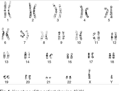 Figure 1 from [A Case of 46,XY pure gonadal dysgenesis with loss of the sex-determining region ...