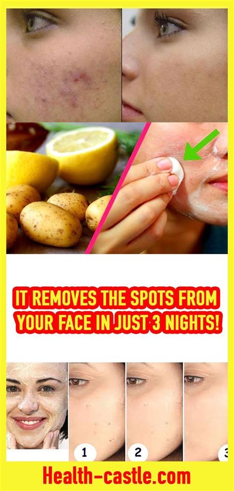 IT REMOVES THE SPOTS FROM YOUR FACE IN JUST 3 NIGHTS! As you age, you ...