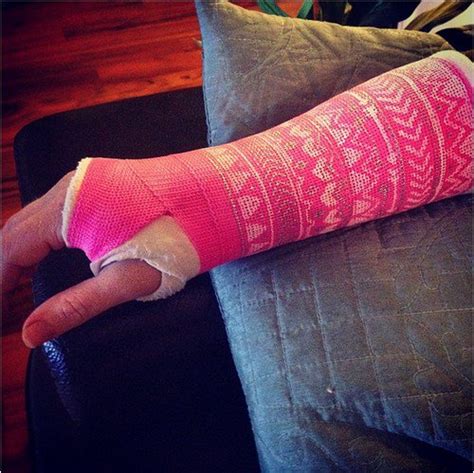 16 People Making The Best Out Of A Bad Situation With Their Casts