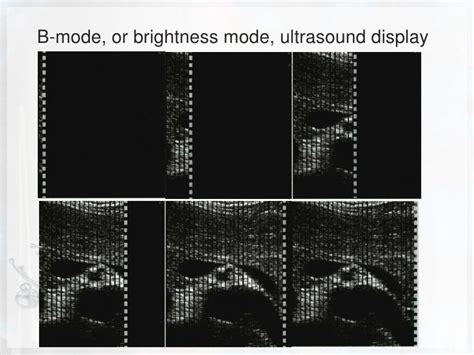 Basic physics of ultrasound.JH