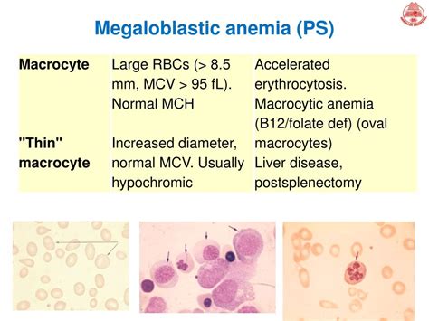 PPT - Peripheral blood smear examination PowerPoint Presentation, free ...