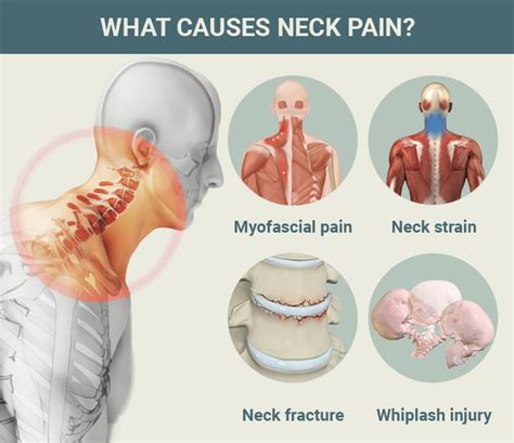 What Causes Neck Pain Infographic - vrogue.co