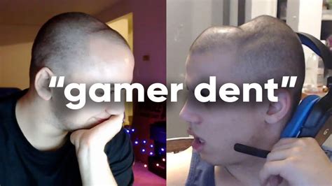 What Is The Dreaded 'Gamer Dent'? The Meme Mocking A Headphone-Shaped 'Dent' On The Skulls Of ...