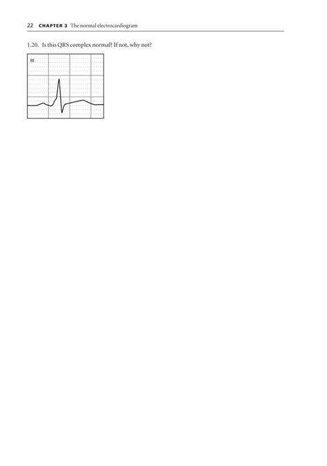 Ecg interpretation