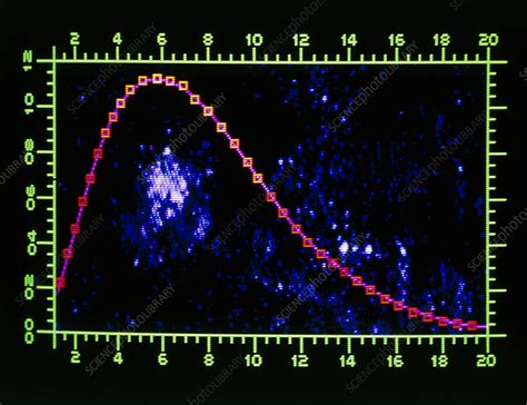 Spectrum of the cosmic background radiation - Stock Image - R980/0015 - Science Photo Library