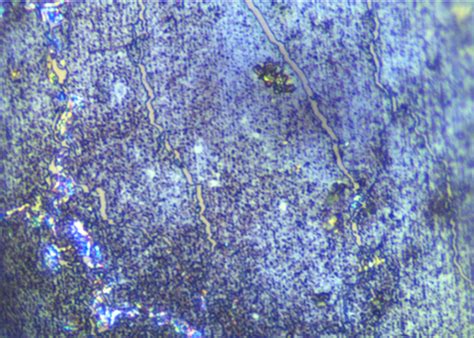 Proteus mirabilis | Mechanisms of Pathogenicity