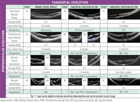 Macular Hole