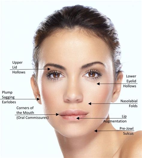 Dermal fillers are not just for nasolabial folds and lips. Check out these off-label ...