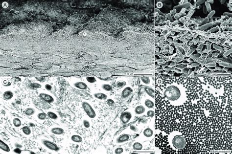 Wound histology in the electron microscope, twenty hours after the... | Download Scientific Diagram