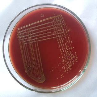 (PDF) Unforeseeable presentation of Chryseobacterium indologenes infection in a paediatric patient