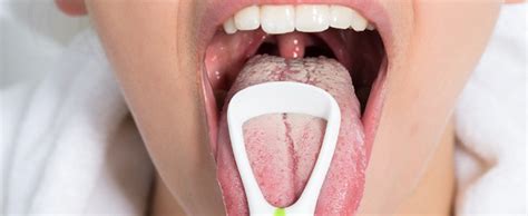 What Bacteria Lives In A Human Mouth? | AP Smilecare | Blackburn