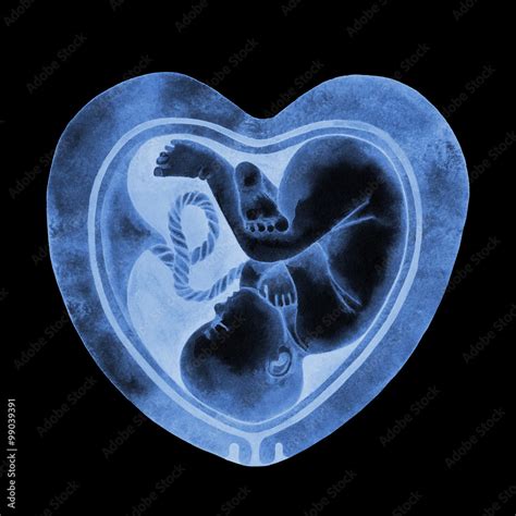 Ultrasound of fetus inside the womb Stock Illustration | Adobe Stock