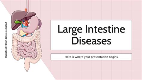 Large Intestine Diseases | Google Slides & PPT