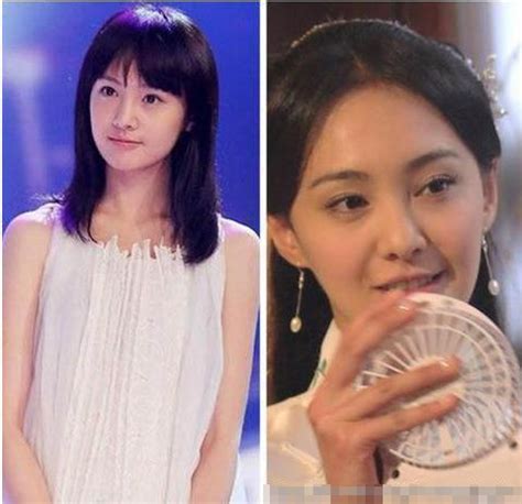 Zheng Shuang Plastic Surgery Before and After – Deer Drama