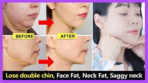 Easy Face exercise | Double chin removal, Face Fat, Neck Fat, Saggy neck and jowls | Look ...