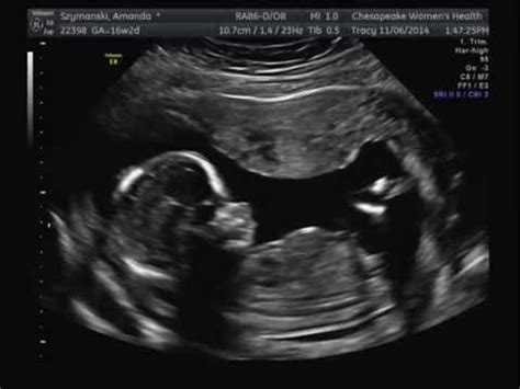 16 Weeks Pregnant Ultrasound - YouTube