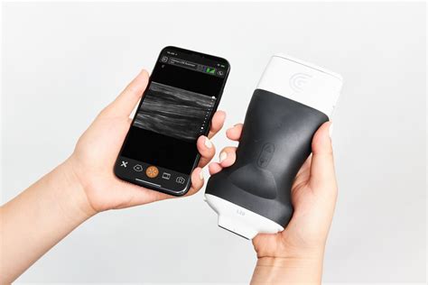 Clarius introduces the world's first ultra-high frequency handheld ultrasound scanner - NS ...