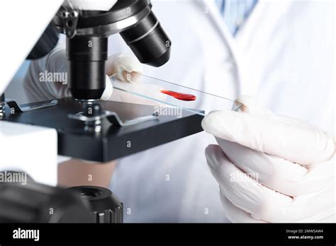 Scientist holding slide with blood sample near microscope in laboratory ...