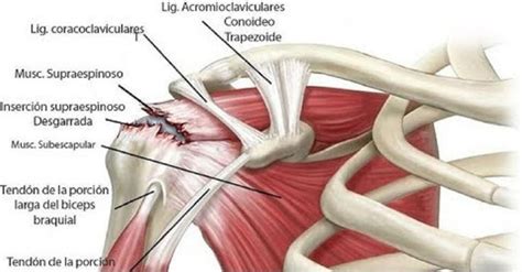 Habitualmente, padecemos dolores musculares, los cuales podrían tratarse en diferentes zonas, ya ...