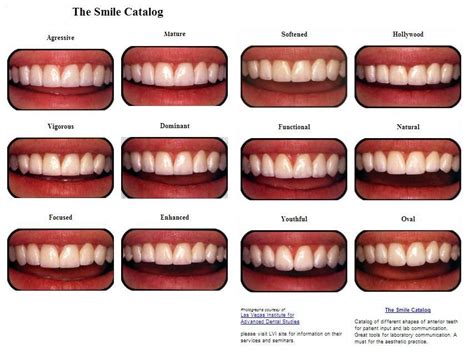 Dentist Tooth Color Chart