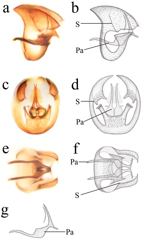 Two new species of Semidalis Enderlein, 1905 (Neuroptera, Coniopterygidae) from China, with an ...