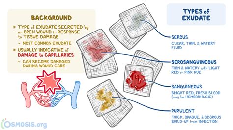 Serosanguineous: What Is It, Appearance, and More | Osmosis | Tissue ...