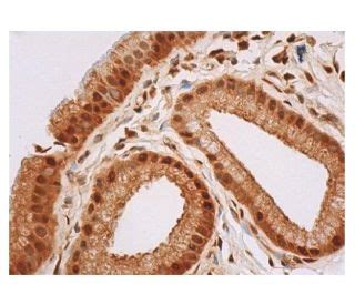 MMP2 Antibody (4D3) | SCBT - Santa Cruz Biotechnology