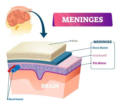 Méningite (bactérienne, virale) : définition, symptômes, contagion, vaccin