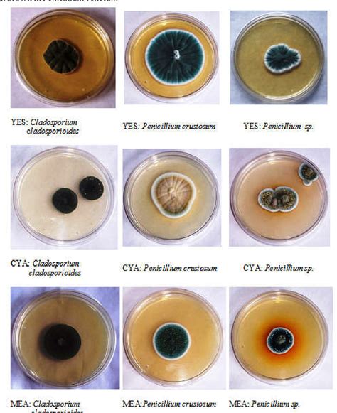 Colonial and Morphological Characteristics of various fungi Species ...