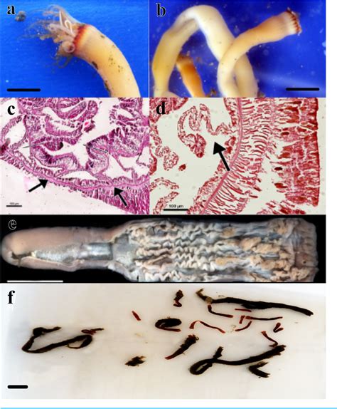 Figure 1 from Description and life cycle of a new species of the genus Arachnanthus (Cnidaria ...