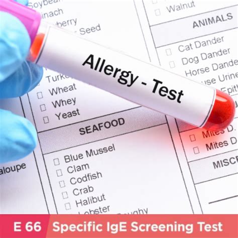 Allergy IgE Test (E66 items)