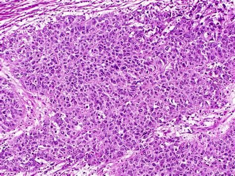 Histopathology of the uterine cervix - digital atlas