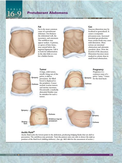 Pin by Waznee on Physical Exam | Abdominal, Abdomen, Leather glove