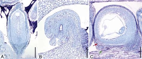 Diversity in ovule curvature. Median longitudinal microtome sections ...