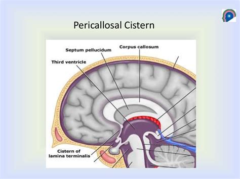 Cisterns of brain