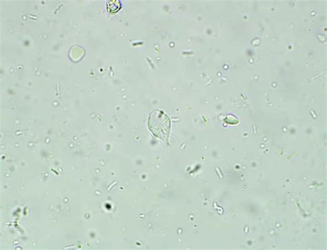 Giardiasis in Dogs : Understanding Giardia in Dogs