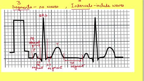 Ecg Diagram And Mean Intervals And Segments