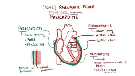 Physicians Are Employing AI To Detect Heart Conditions in Children - AI ...