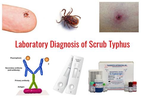 Laboratory Diagnosis of Scrub Typhus