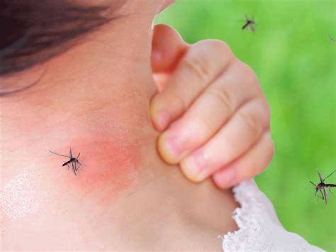 How to know if you’ve been bitten by a dengue mosquito: 5 facts about the Aedes aegypti mosquito ...