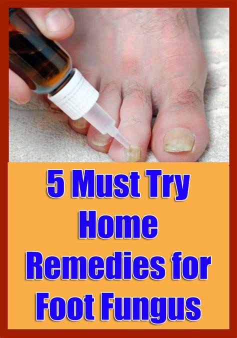 5 Must Try Home Remedies for Foot Fungus in 2020 | Home remedies, Foot fungus remedies, Remedies